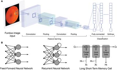 Artificial intelligence promotes the diagnosis and screening of diabetic retinopathy